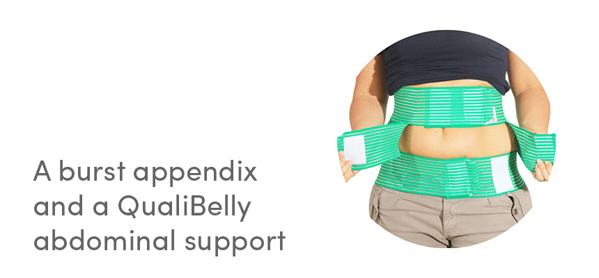 A burst appendix and a QualiBelly abdominal support